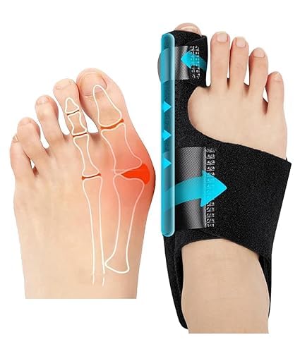 ALINO Bunion Corrector | Adjustable Toe Straightener for Men & Women | Toe Corrector Universal Fit for Left & Right Foot | Leg Finger Straightener