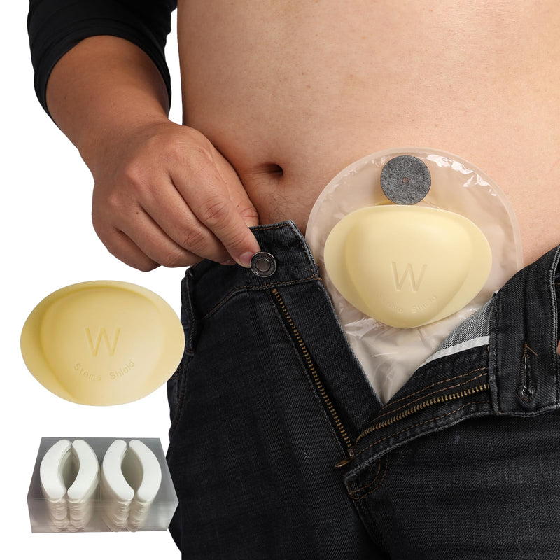 [Australia] - Stoma Guard and 50 Pairs of Stickers | Ultimate Protection for Your Ostomy Bag 