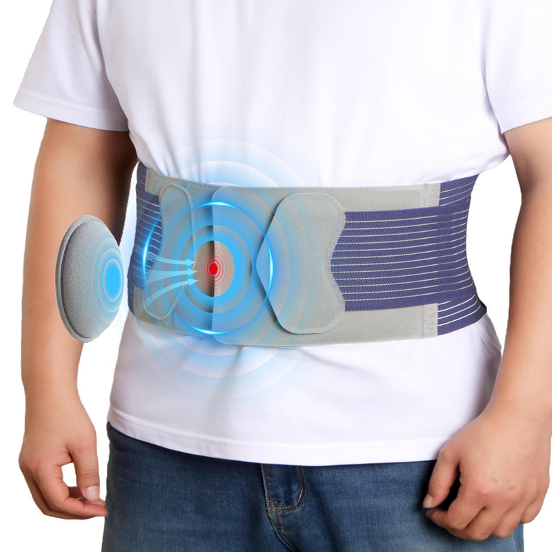 Hernia Belts for Men and Women – Front-Closure Abdominal Binder with Extra Compression Strap & Soft Detachable Dual-Layer Hernia Pad – Comfortable Hernia Support for Men Post Surgery or Daily Relief (S/M 28–38 in) S/M