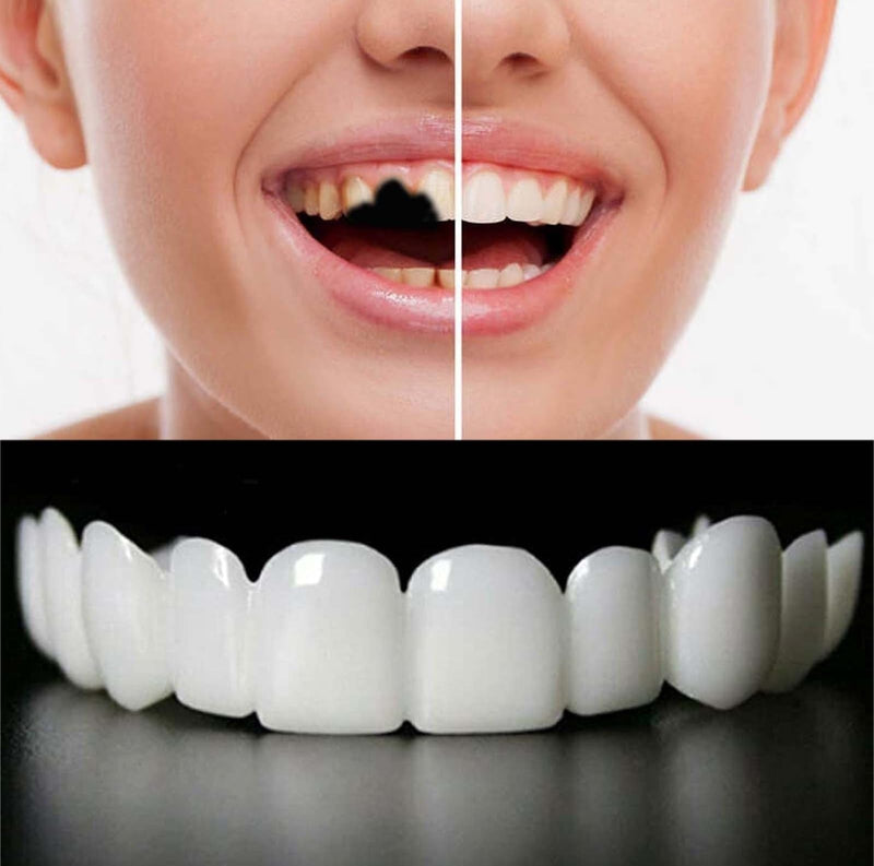 [Australia] - 2 Pairs,Regain Confidence Smile,Adjustable for Men and Women,Beautiful Smile(White) 