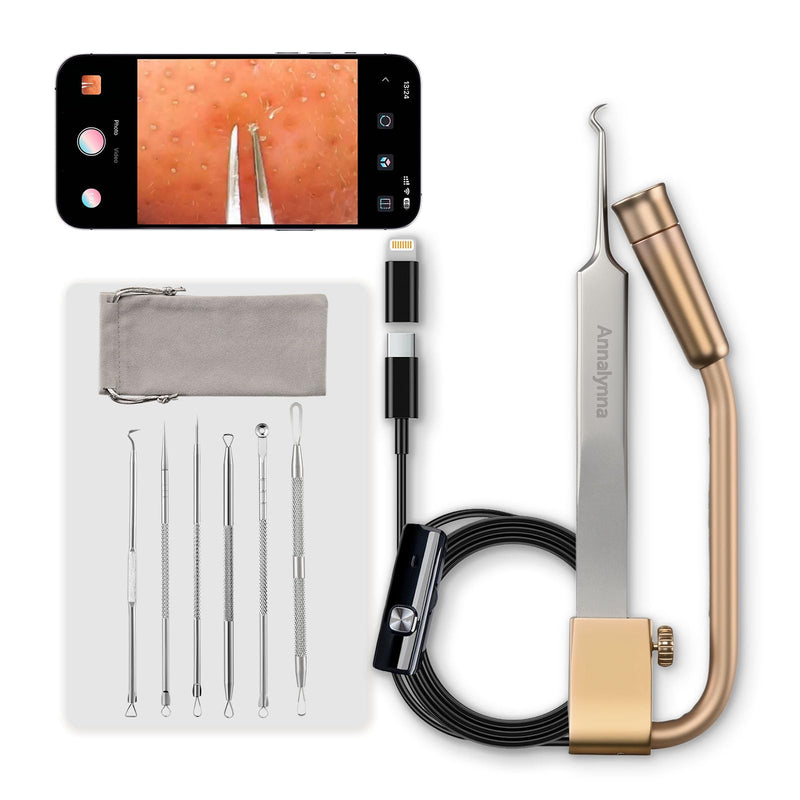 Luma 1 Visual Blackhead Remover Tweezers with Camera - Pimple Popper Tool with Camera 20x Magnification, 1080P, 8 LED Lights, with Blackhead Remover Pimple Popper Tool Kit (6 Piece Kit),Rose Gold Luma 1 Curved Single (Rose Gold)