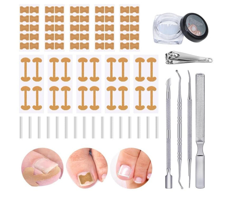 Professional Ingrown Toenail Treatment Set with Breathable Ingrown Toenail Strips,Ingrown Toenail Removal Kit,Curved Toenails Corrector Patch, Ingrown Toenail Corrector Tool Set for Home Use