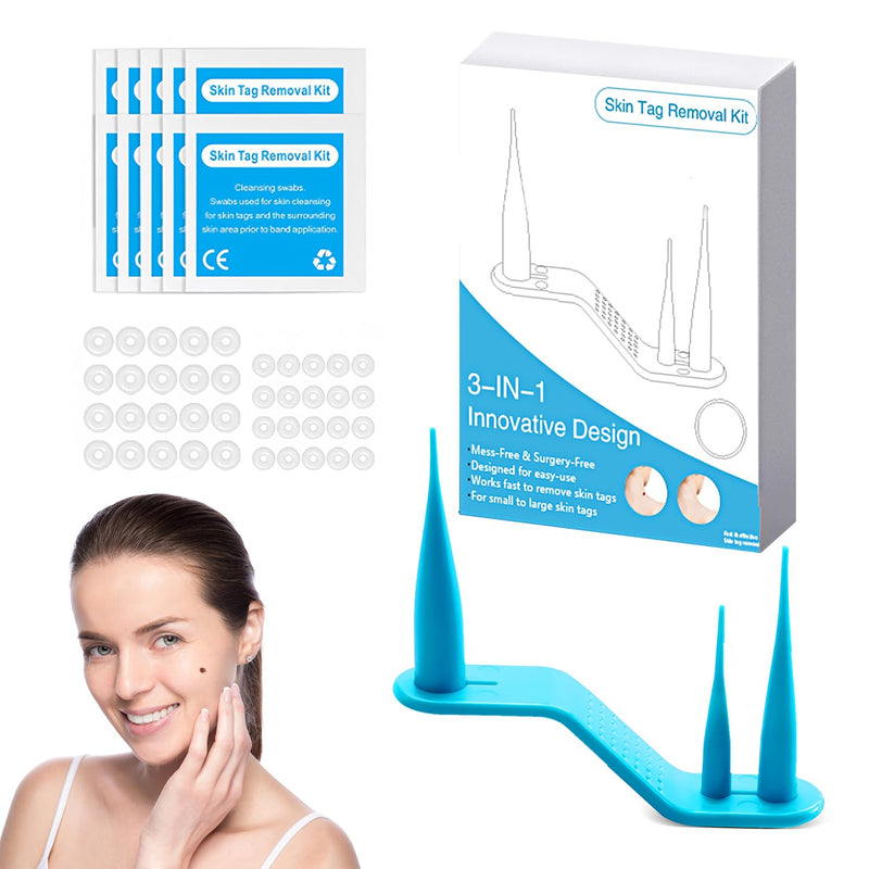 [Australia] - Stalk wart remover, 3-in-1 stalk wart remover, fibroma remover, skin tag remover kit, physical removal of skin tags, quick, safe, pain-free stalk wart removal device 