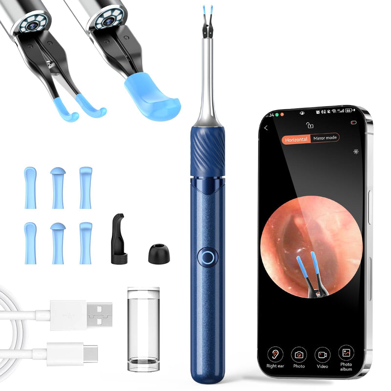 [Australia] - Earwax Remover Otoscope, VITCOCO 1080P Ear Cleaner, 3.2mm Ear Cleaner with Tweezers, Wi-Fi Ear Cleaning, Waterproof Ear Cleaner for Adults, Children and Pets Blue 
