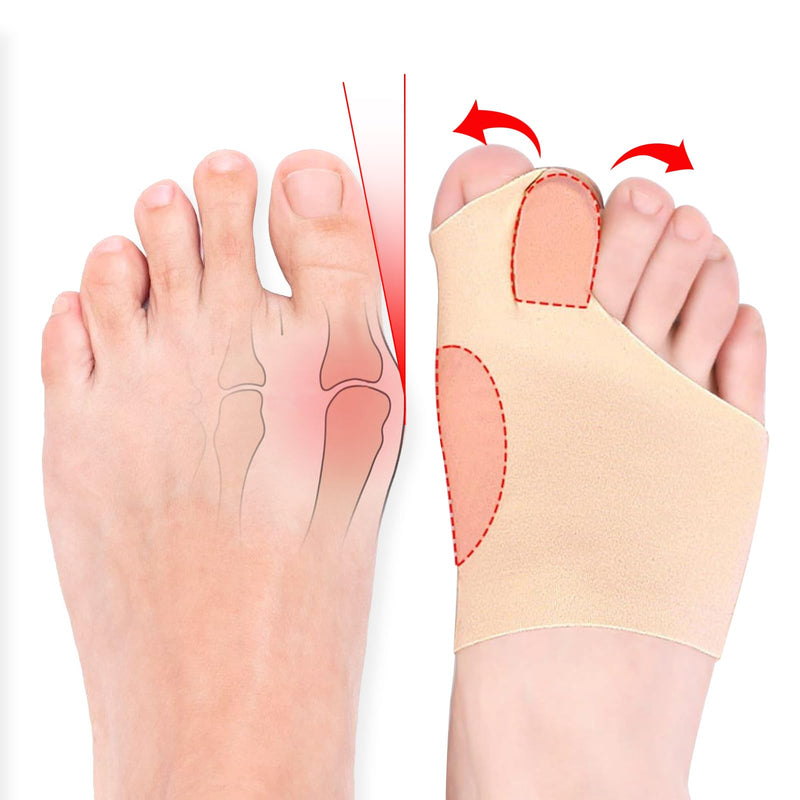 [Australia] - TCASENER Hallux Valgus Correction Bandage, Hallux Socks, Toe Separator Hallux Valgus Correction Washable, Silicone Bandage Toe Spreader Hallux Valgus for Men and Women MWFJIAOT01 