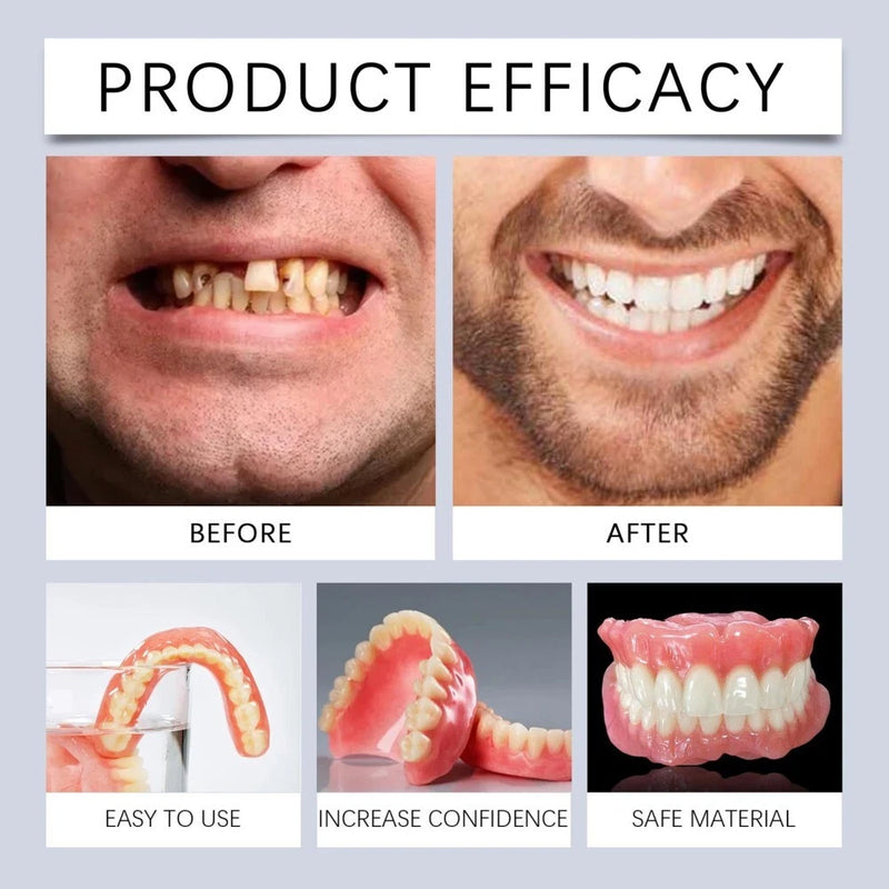 Bikenda Silicone Dental Prostheses Prosthesis Modification Set Silicone Dental Prostheses, Dentures Prosthesis Complete, Clip-on Dentures, Denture Silicone Reline Kit Temporary Dentures