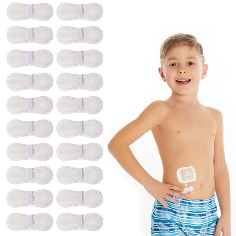20 Pcs Low-Profile Catheter Stabilization Device for Kids & Babies, G-Tube, PEG & PD Feeding Tube Holder Patch, Gentle Abdominal Support Sticker (White) White 1