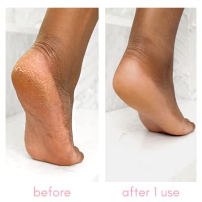[Australia] - Kiara Sky Heeling Callus Remover (Bottle) Bottle 