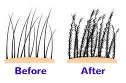 [Australia] - Hair Loss Treatment for Women - Men, Hair Fibres Create Increased Volume Hair Thickener. Hair Fibres Dark Brown Hair Building Fibres 