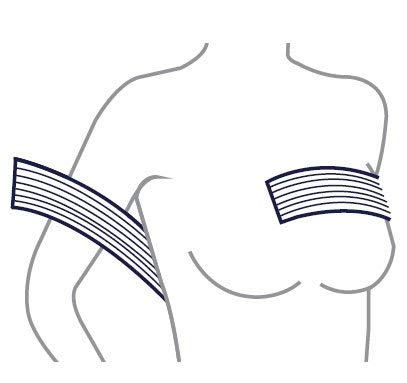 [Australia] - CAREFIX Implant Stabilizer Band (8113) White by TYTEX- Post-Surgery Breast Implant Support Band- Chest Compression Support- Breast Augmentation Strap 1 Count (Pack of 1) 