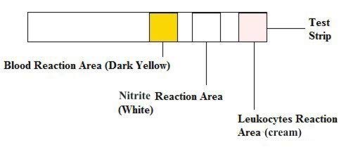 [Australia] - UTI Urine Test Strips Urinary Tract Infection Cystitis Tests Nitrite, Leukocytes and Blood - 2 Individual Tests… 