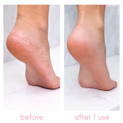 [Australia] - Kiara Sky Heeling Callus Remover (Bottle) Bottle 