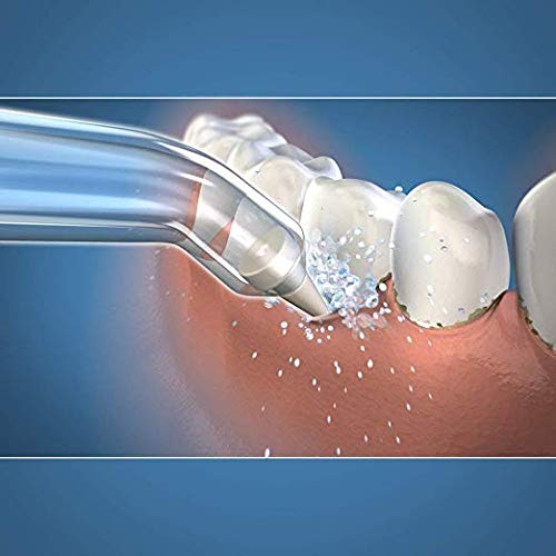 [Australia] - YanBan 2pcs Dental Water Jet Tips Refills for Waterpik, Replacement Dental Water Oral Irrigator for WP-100, WP-250, WP-300, WP-450, WP-660, WP-900 