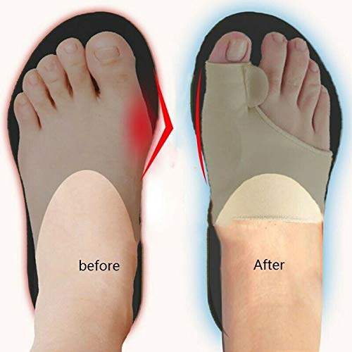 [Australia] - HiiBaby 2pcs Big Bone Orthopedic Bunion Correction Pedicure Socks Silicone Hallux Valgus Corrector Braces Toes Separator Feet Care Tool 