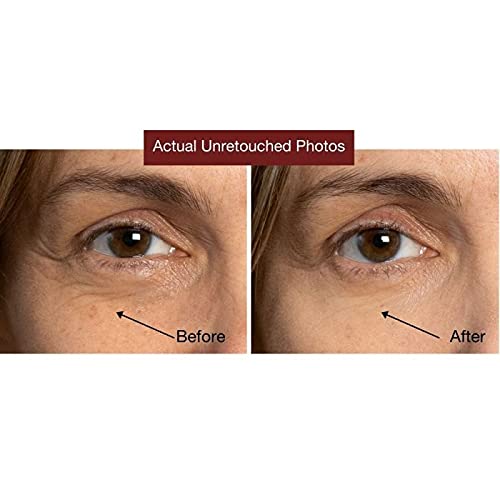 [Australia] - Tight Lift & Cover 3-in-1 Undereye Tightener & Concealer by Jerome Alexander - Conceals Dark Circles, Reduces Under Eye Bags, and Minimizes the Appearance of Fine Lines & Wrinkles (Dark) 