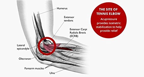 [Australia] - Thera Point Acupressure Tennis Elbow Brace with Acupressure Point for Tendonitis - Relief for Men & Women with Golfer's Elbow - Comfortable Sleeve for Golf Elbow Treatment Large/X-Large (Pack of 1) 