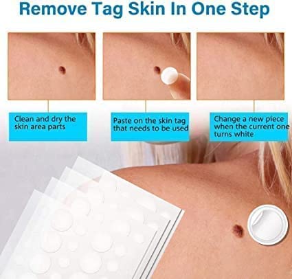 [Australia] - Skin Tag Removal, 144Pcs Skin Tag Remover Patches, Premium Formula Skin Tag Removal, Tag Dry and Fall Away, Natural Ingredients, Safe and Effective 