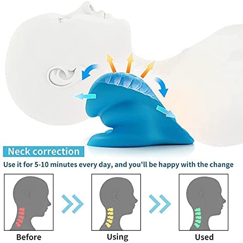 [Australia] - REARAND® Neck Stretcher,Neck and Shoulder Relaxer ,Neck Cloud for TMJ Pain Relief and Cervical Spine Alignment ,Neck Pain Relief Chiropractic Pillow,Posture Corrector 