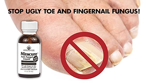 [Australia] - Miracure Anti-Fungal Treatment 1 ounce bottle with 10 Toe Separators and Brush with UltraAloe 