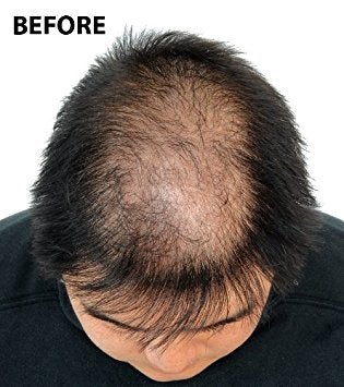 [Australia] - Super Million Hair - 15g Hair Fibres - No.8 Auburn 