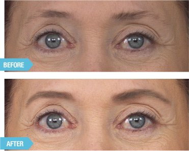 [Australia] - WUNDERBROW Wunderbrow Waterproof Eyebrow Gel, Auburn, Vegan and Cruelty-Free 1 Count (Pack of 1) 