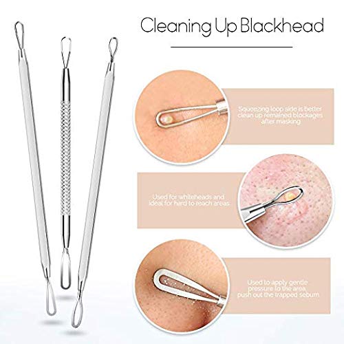 [Australia] - Pimple Popper Tool,7Pcs Blackhead Remover Tool Kit Facial Extractor for Zit Popper Whitehead Acne Blemish Comedone Removing For Nose Face Skin (1PACK) 1PACK 