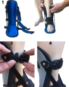 [Australia] - Alpha Medical Plantar Fascitis Night Splint Heel & Foot Pain; P.F. Brace L4398 (Large {Men's shoe size 10.5 and up / Women's shoe size 11 and up}) Large 