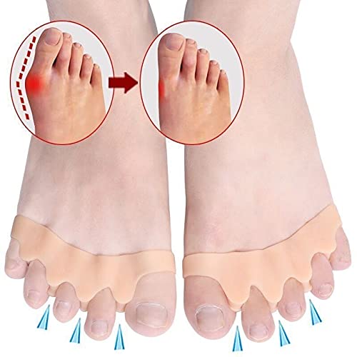 [Australia] - ERSANLI Foot Care Toe Separator / Bonny Separator. Can Relieve Pain, Repair Bunions, Hammer Toes, Overlap Toes, Toe Stretchers, Separate, Protect And Relax Toes (Unisex, Beige, 2 Pcs) 