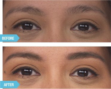 [Australia] - WUNDERBROW Wunderbrow Waterproof Eyebrow Gel, Auburn, Vegan and Cruelty-Free 1 Count (Pack of 1) 