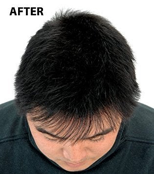 [Australia] - Super Million Hair 15g Hair Fibres - Black 