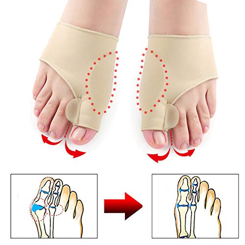 [Australia] - HiiBaby 2pcs Big Bone Orthopedic Bunion Correction Pedicure Socks Silicone Hallux Valgus Corrector Braces Toes Separator Feet Care Tool 