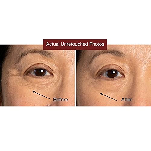 [Australia] - Tight Lift & Cover 3-in-1 Undereye Tightener & Concealer by Jerome Alexander - Conceals Dark Circles, Reduces Under Eye Bags, and Minimizes the Appearance of Fine Lines & Wrinkles (Dark) 
