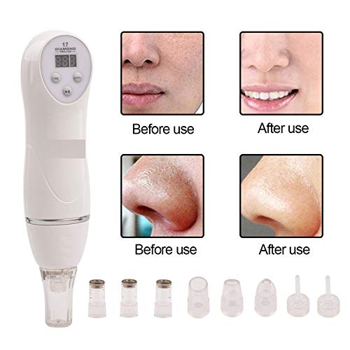 [Australia] - YAVOCOS 6 Tips Blackhead Vacuum Suction Remover Machine Mini Diamond 17 Dermabrasion Skin Peeling Digital Beauty Device Facial Pores Cleaner 