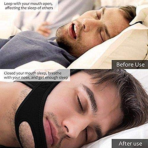 [Australia] - VANVENE Stop Snoring CPAP Chin Strap and Anti Snoring Solution,Adjustable Anti-Snore Supporter Device (Blue Strap) 