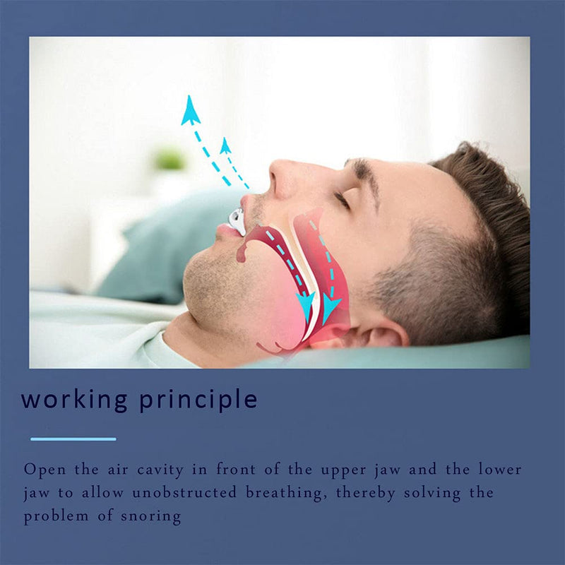 [Australia] - Snore Stopper Mouth Guard Anti Snoring Solution With 4 Nose Vent For Easing Breathing And Comfortable Sleep Suitable For Men And Women 