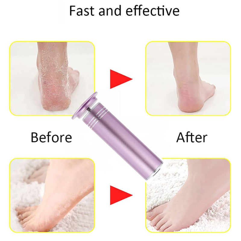 [Australia] - 1200 RPM Electric Foot Sharpener Adjustable Speed Foot Polisher, Dead Skin Calluses Remover with 60 Replacement Sandpaper Discs, Unisex. 