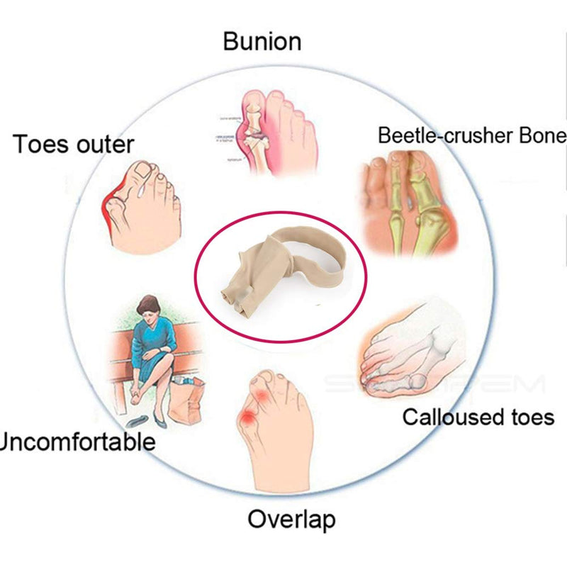 [Australia] - Bunion Straightener Protector Relief Sleeve w/Gel Bunion Stretchy Pads Cushioned Splint, Orthopedic Hallux Valgus Overlapping Corrector Bootie Guard Hammer Toe Pain Aid Surgery Treatment 2 Pc Large (Pack of 2) 