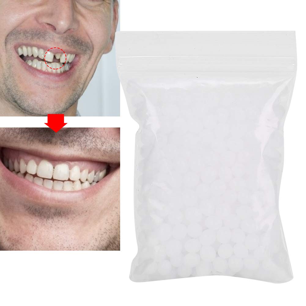 [Australia] - Temporary Tooth Repair Beads For Missing Tooth Filling Material With Broken Teeth, Multifunction Temporary Tooth Repair Set Plastic (100g) 100g 