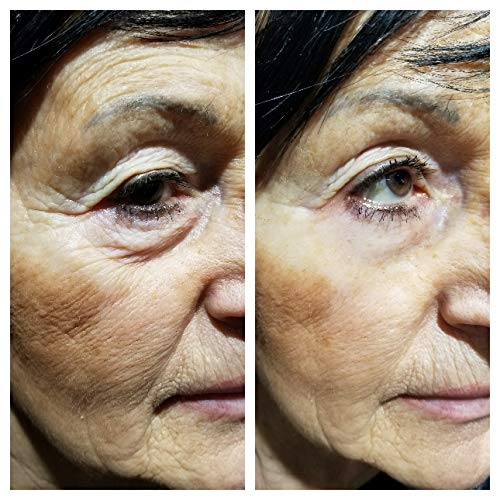 [Australia] - Vitayes Instant Ageback Ageless Facelift Cream for Instant Under Eye Bag Removal, Dark Circles and Fine Lines (7 ml Tube) 