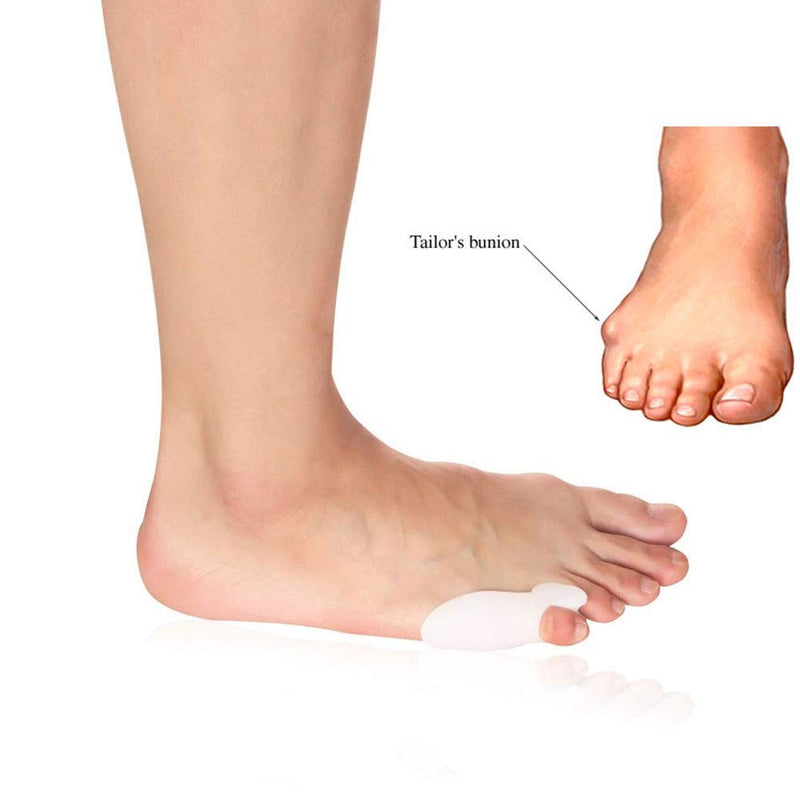[Australia] - Tailor's Bunion Corrector by Pedimend - Small Toe Separators/Stretchers - Bunion Pain Relief - Prevent Corns/Callus - Pinky Toe Alignment - for Women & Men - Foot Care 