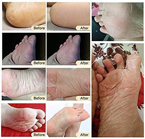 [Australia] - 3 Pack Foot Peel Mask,Exfoliating Foot Socks Calluses Remover Dead Skin, Aloe Moisturizing Feet Peeling Mask for Dry Skin,Cracked Heels,Foot SPA Socks for Women and Men (Rose) Rose 