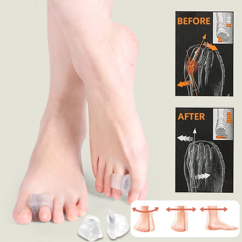 [Australia] - Toe Separators Gel- Big Toe Spacers - Corrector and Spacer- Bunion Corrector and Bunion Relief - Pads for Overlapping,Yoga 