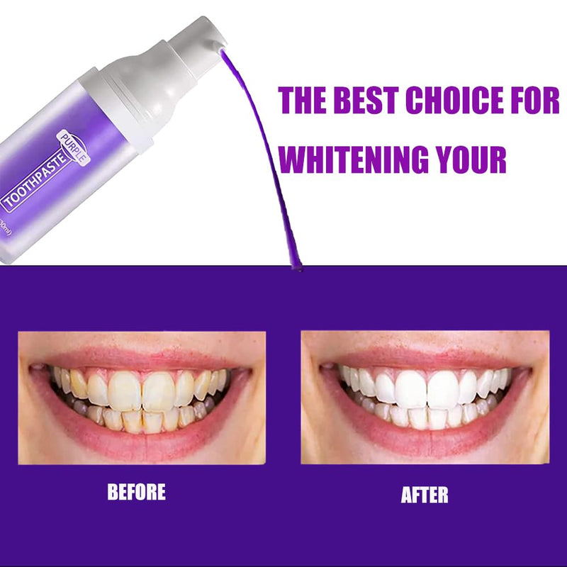 [Australia] - Purple Toothpaste for Teeth Whitening, Purple Toothpaste, Purple Corrector Toothpaste, Teeth Whitening Toothpaste, Tooth Paint Teeth Whitening Booster 