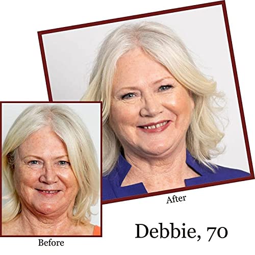 [Australia] - Tight Lift & Cover 3-in-1 Undereye Tightener & Concealer by Jerome Alexander - Conceals Dark Circles, Reduces Under Eye Bags, and Minimizes the Appearance of Fine Lines & Wrinkles (Dark) 