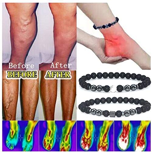 [Australia] - INENIMARTJ 2Pcs Anti-Swelling Black Obsidian Anklet Magnetic Therapy Ankle Bracelet for Women Men, Adjustable Magnet Weight Loss Ankle Bracelet Anti-Anxiety Yoga Beads Bracelet A:map 