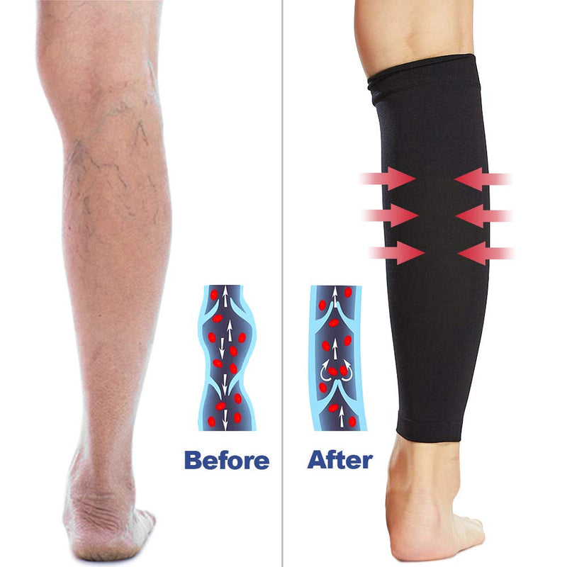 [Australia] - Beister 1 Pair Compression Calf Sleeves (20-30mmHg), Perfect Calf Compression Socks for Running, Shin Splint, Medical, Calf Pain Relief, Air Travel, Nursing, Cycling Medium Black 