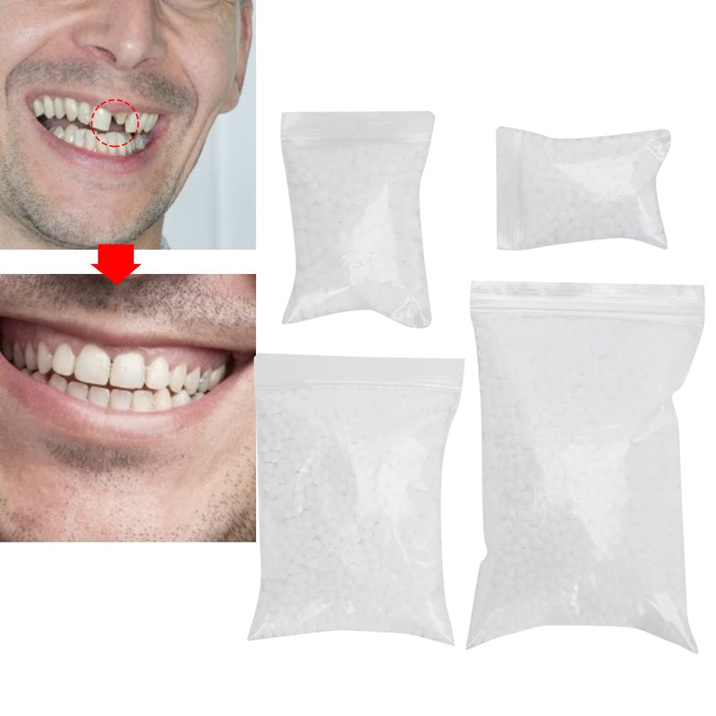 [Australia] - Temporary Tooth Repair Beads, For Missing Dental Filling Material With Broken Teeth, Cosmetic Teeth Whiten Teeth Temporary Tooth Repair For Snap Lid Missing(F2) F2 