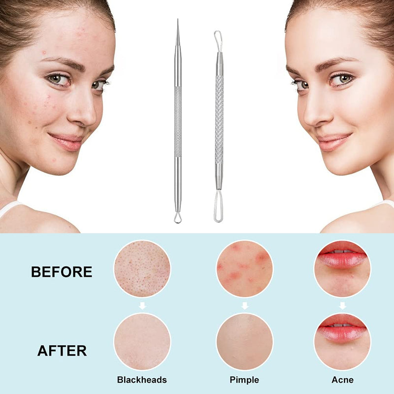 [Australia] - Blackhead Remover, 2 PCS Pimple Popper Tool，Stainless Steel Pimple Extractor Blackhead Removal Tool Risk Free Treatment for Blemish,Whitehead Popping,Blemish 