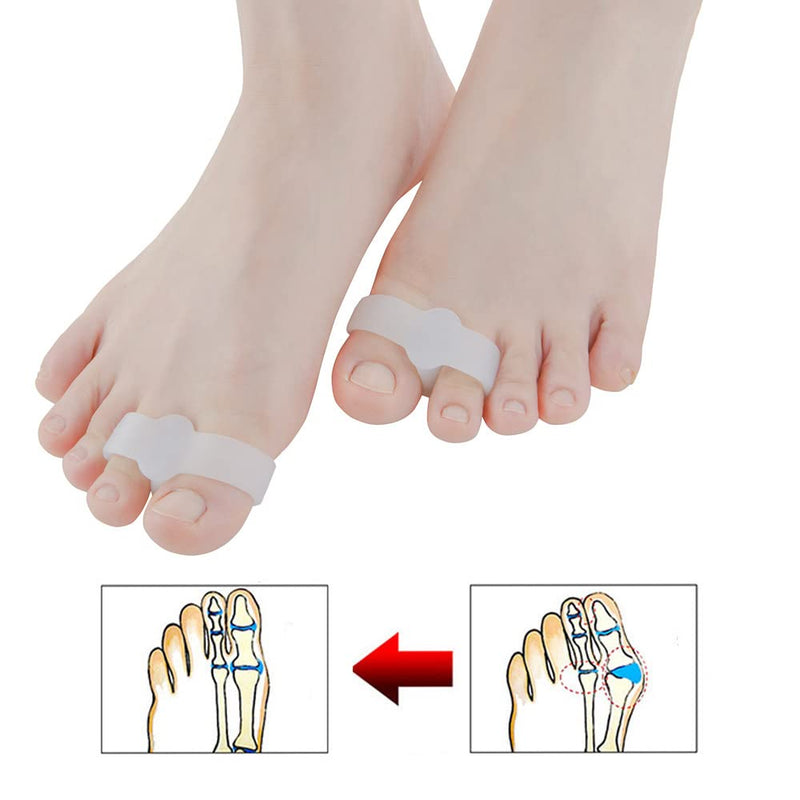 [Australia] - 10Pcs Gel Toe Separators Silicone Bunion Splints Bunion Correctors Toe Separators with 2 Loops Suitable for Bunion and Overlap Toe 