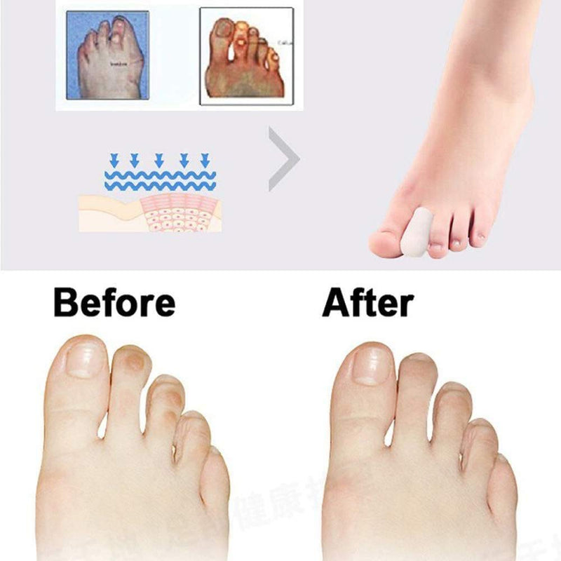 [Australia] - Dr.Pedi 5 Pair Big Toe Gel Toe Caps Pads reathable Silicone Gel Big Toe Sleeves for Ingrown Toenail Big Toe Sleeve 